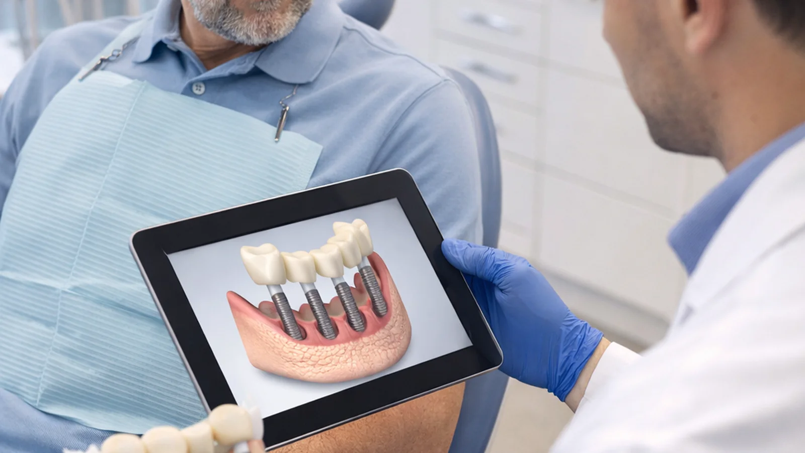 Dental implant consultation with a clinician showing an implant bridge model on a tablet to a patient.